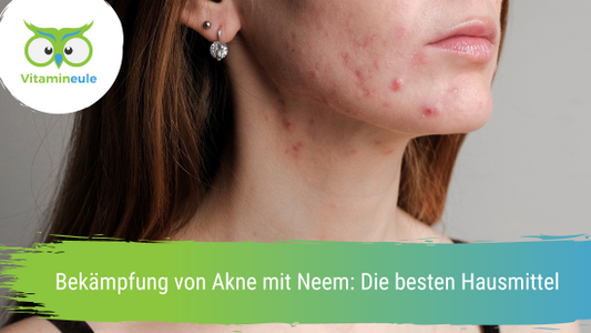 Bekämpfung von Akne mit Neem: Die besten Hausmittel